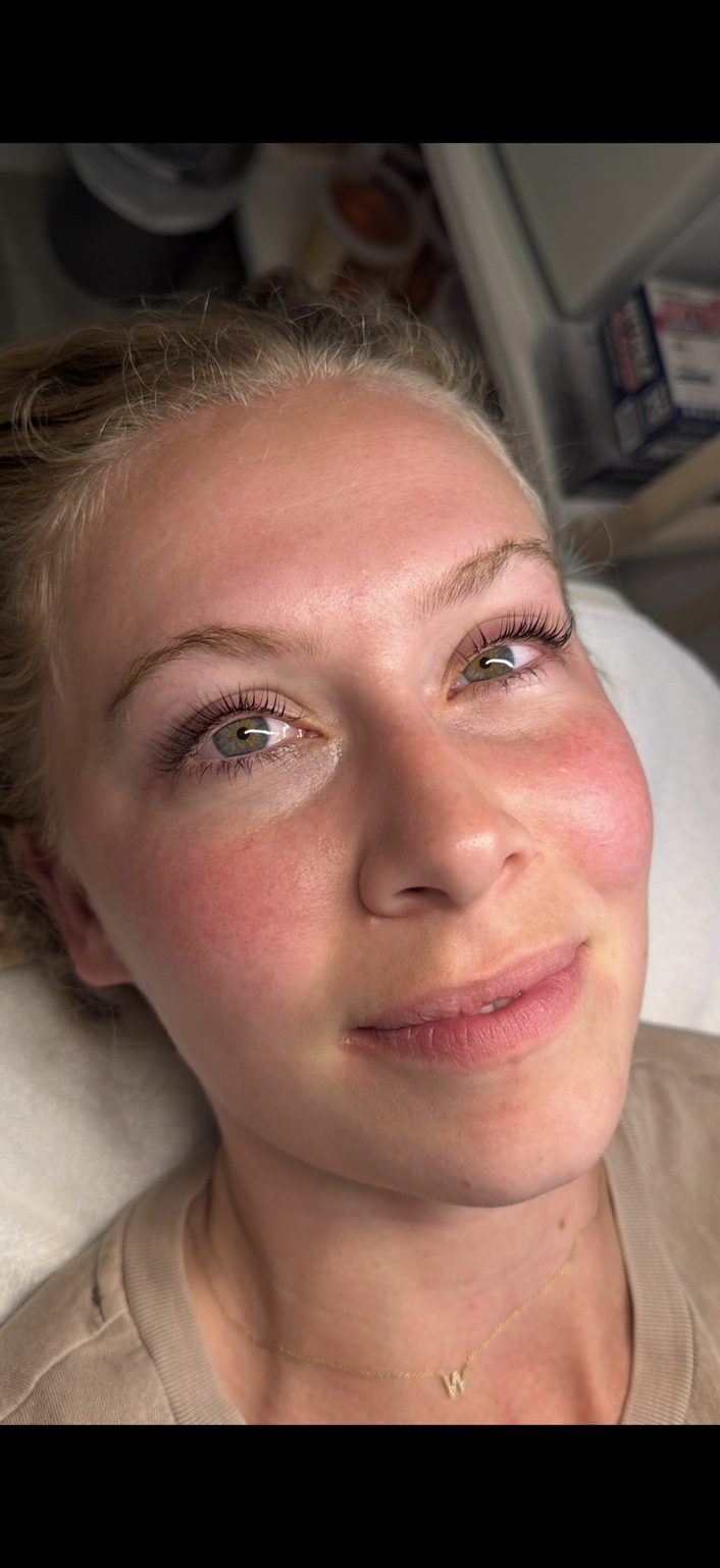 Lash lift after